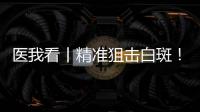 医我看丨精准狙击白斑！这款“港澳药械通”白癜风新药开出澳珠首方